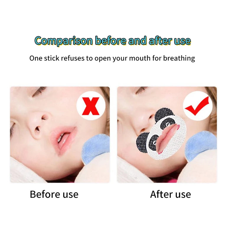 30PCS Correction Lip Nose Breathing Improving Patch For Children Cartoon Night Sleep Mouth Orthosis Tape Anti-Snoring Stickers